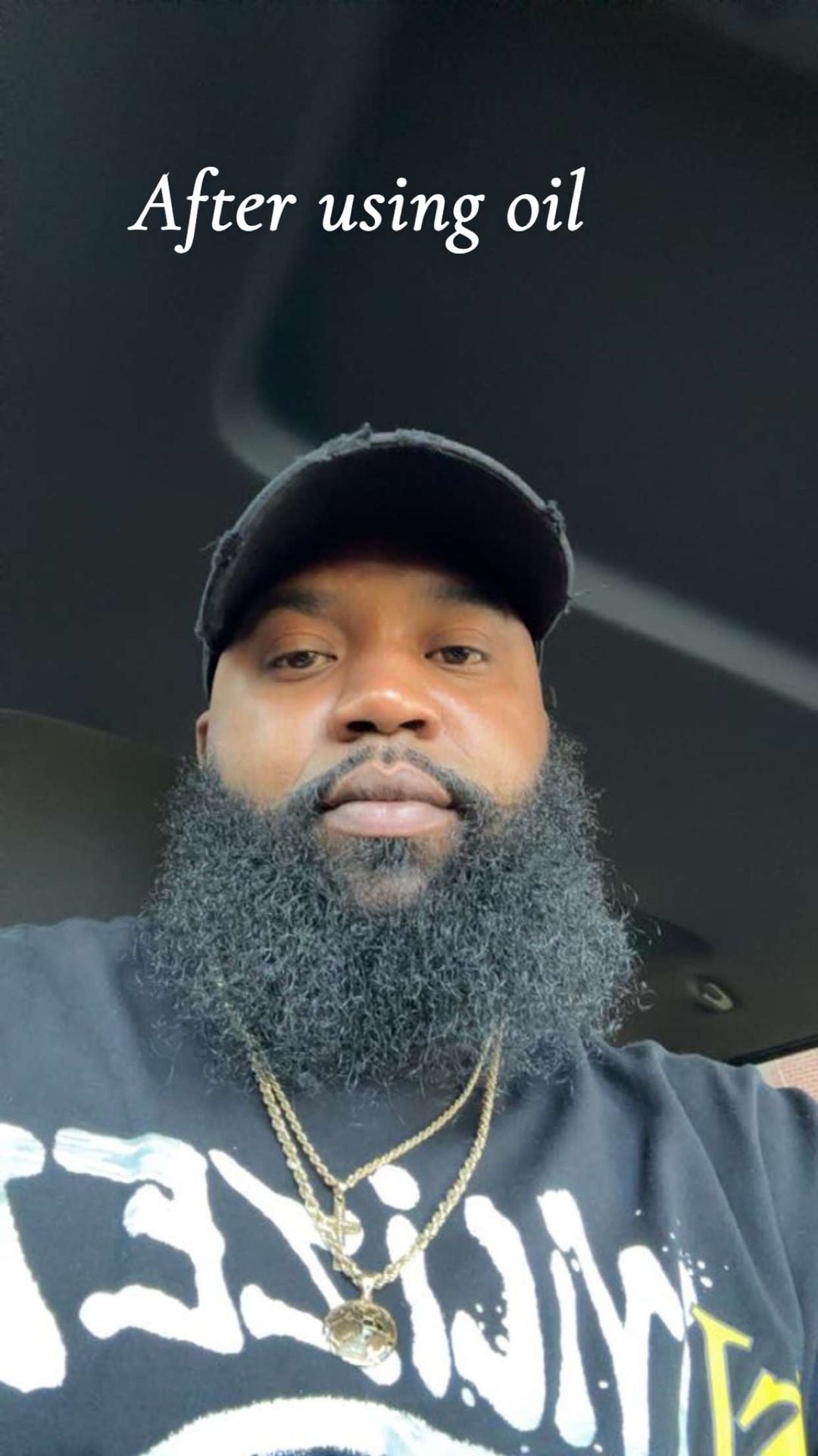 Beard And Hair Growth Oil